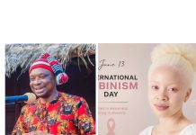 International Albinism Day: Anyaele Demands Greater Inclusion, End to Stigma Against Persons with Albinism